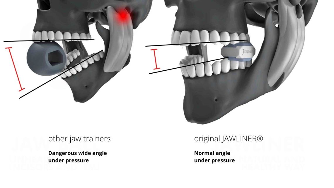 Jawliner là một sản phẩm nhai bằng răng hàm